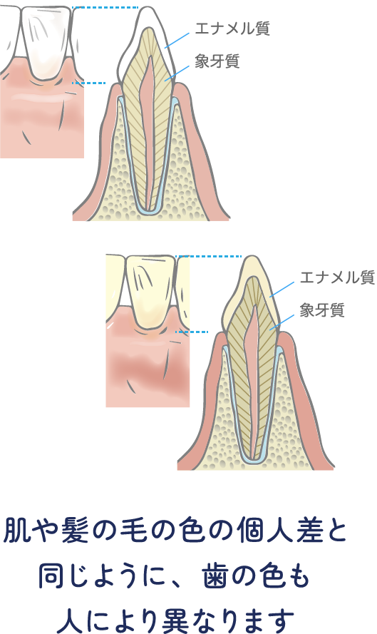 肌や髪の毛の色の個人差と同じように、歯の色も人により異なります。